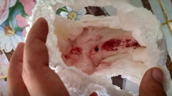 多大的水蛭会钻入人体,小水蛭钻入身体怎么办