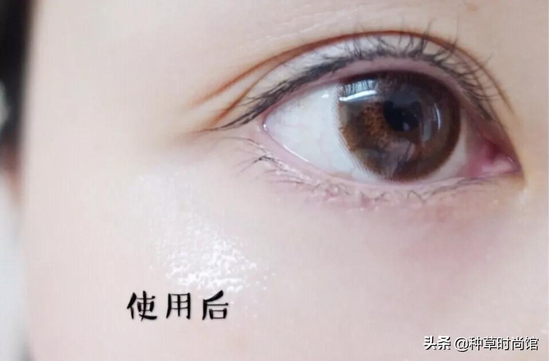 浣犵殑鐪奸湝鏄孩姒滃悧,浣犵殑鐪艰啘鏄笉鏄创閿欎簡