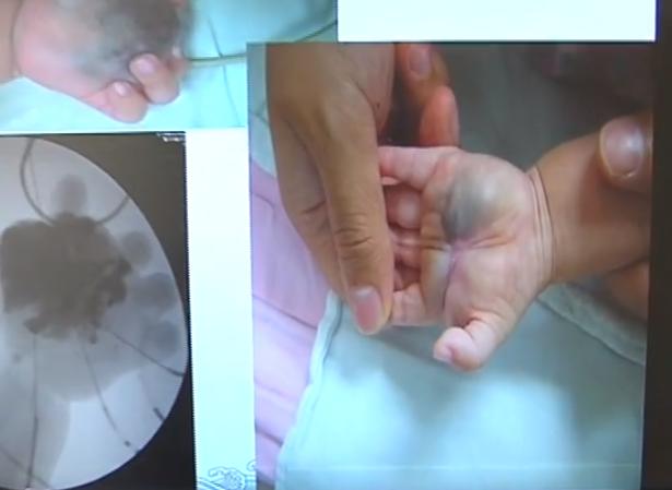 重病小男孩急需送医救治,男孩得怪病四处求医