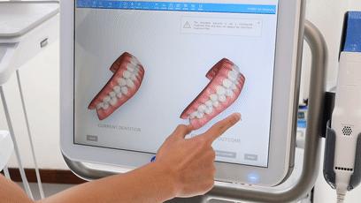 正畸基本操作,口腔正畸常用技巧