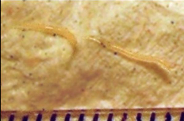 现在小学生要打虫吗,给小孩打虫的季节