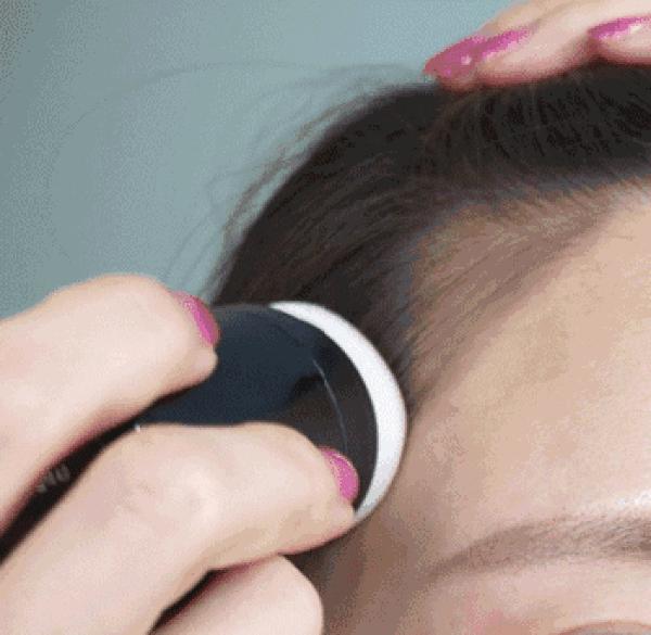 秃头有救了神器,秃头女孩轻松get高颅顶蓬松头发