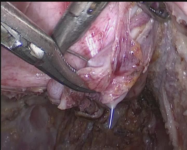 娓崡甯傜浜屽尰闄㈣偪鐦よ兏澶栫,鑲跨槫鍖婚櫌鑳镐簩澶栫