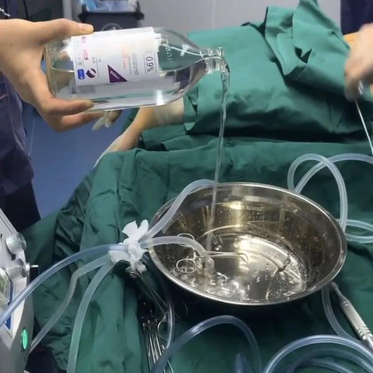 吸脂后腰部有积液抽一次,腰部吸脂一个月还有积液