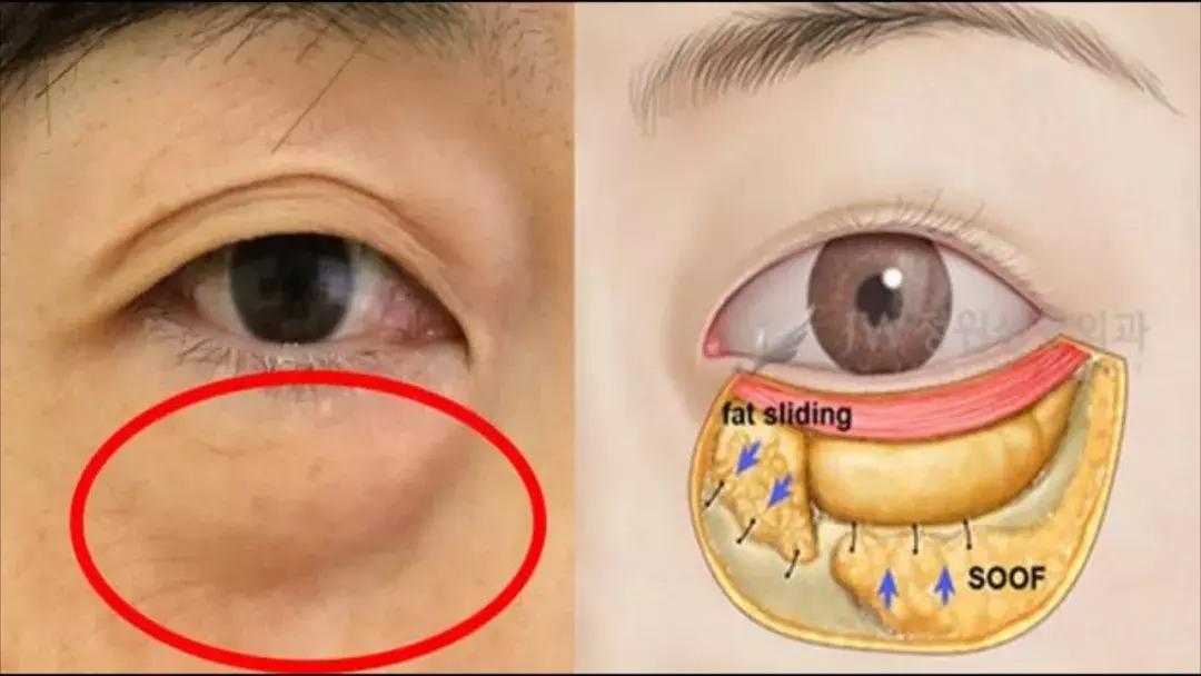 30-40岁最适合的中国眼霜,40岁以后用哪一款眼霜