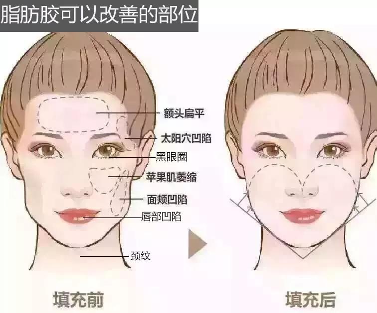 30多岁女的总被小孩子叫姐姐,30岁整天被别人喊姐