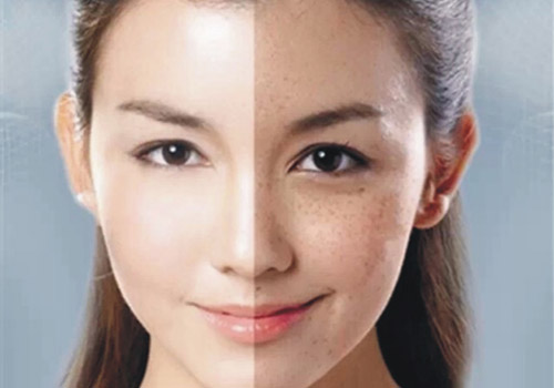 护肤讲堂知识大全,有斑皮肤护肤指南