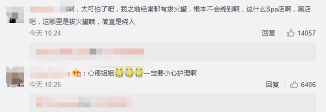 拔火罐被烧伤的明星,拔火罐明星烧伤