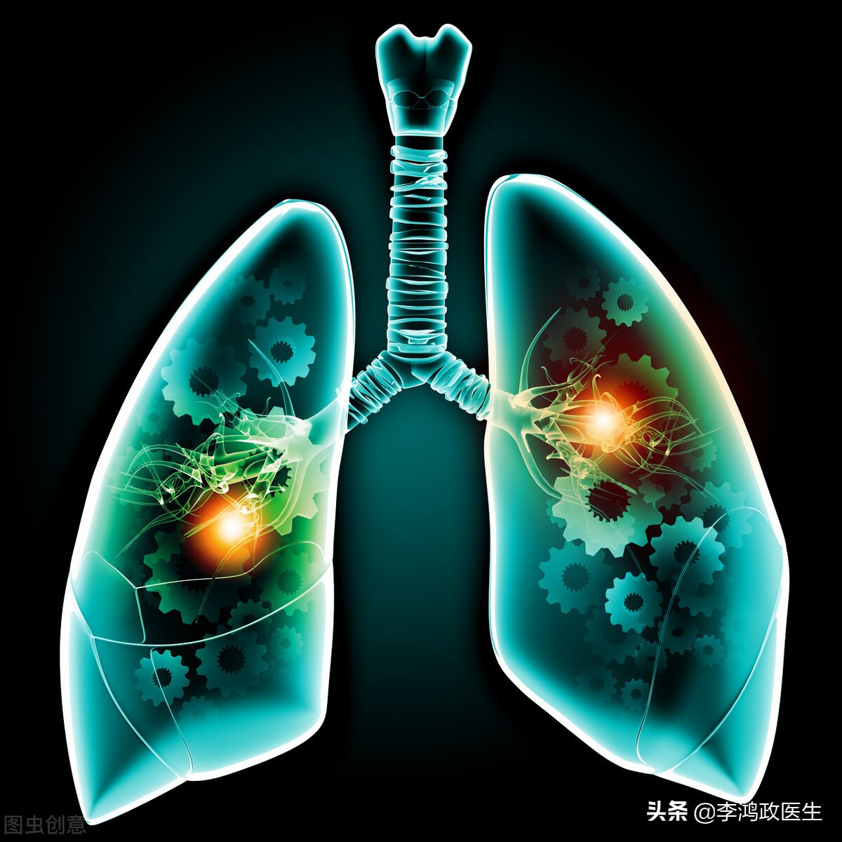 女子怀孕，堕胎后死亡，尸解提示：中毒身亡，流产的事你懂多少？