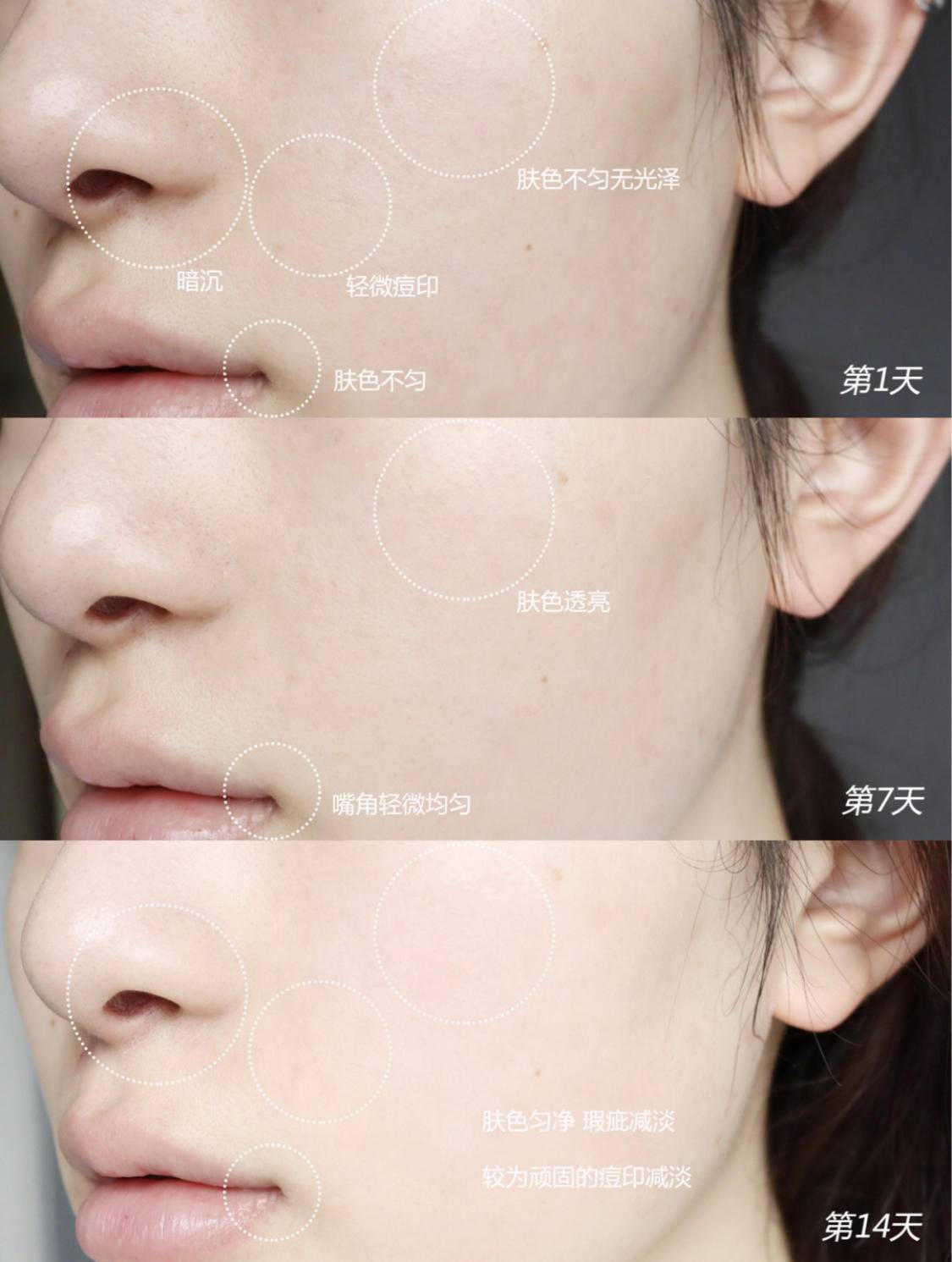 每天美白皮肤还是越来越黑,一直在美白却越来越黑的原因