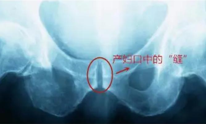 产后护理，盆底肌训练一定要注意