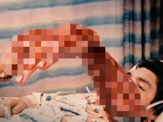 紧急！全澳多地出现“吃人菌”，感染后如同丧尸！24小时可吃一人