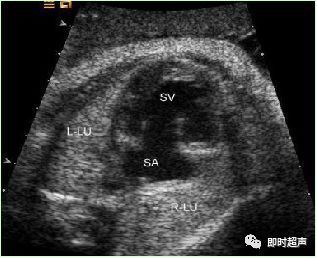 产科常规彩色超声报告单介绍,常见妇科疾病超声报告