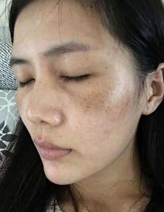 突然长褐斑是什么原因,长期未穿的衣服变黄了怎么解决