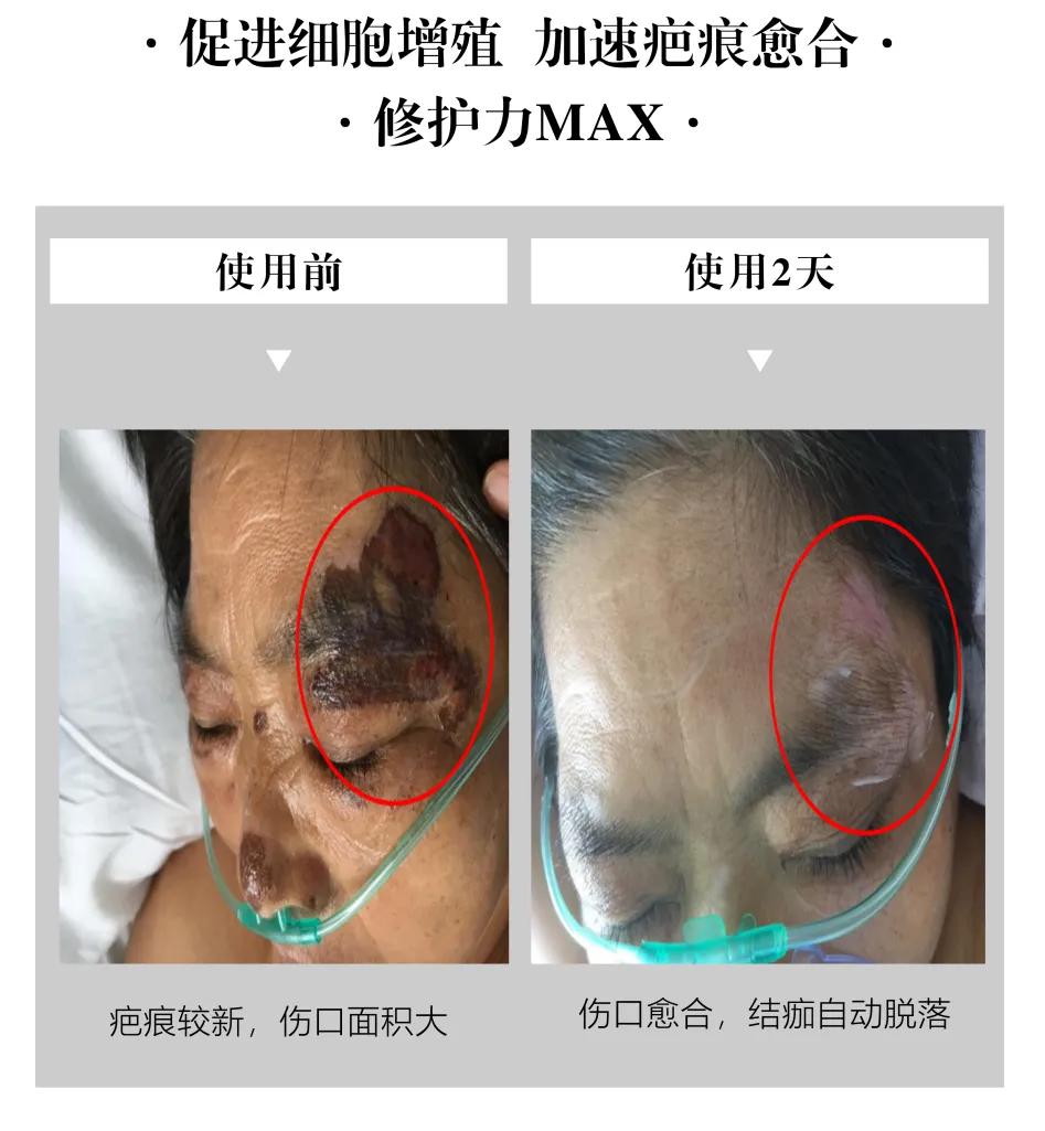 肌肤发红发痒怎么护理,泛红刺痛干痒如何修复