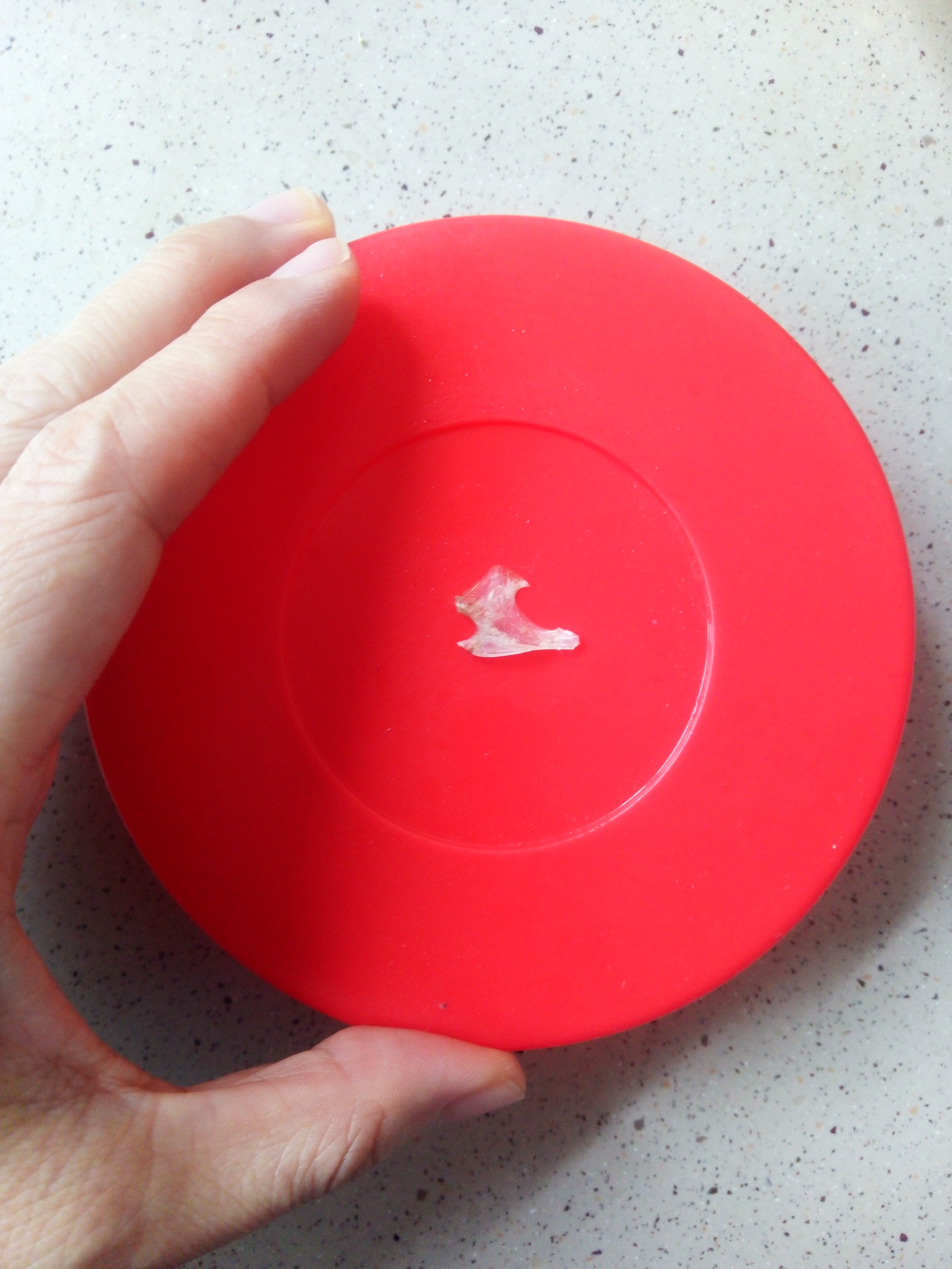 取鱼刺为什么要做胃镜,胃镜取鱼刺全过程