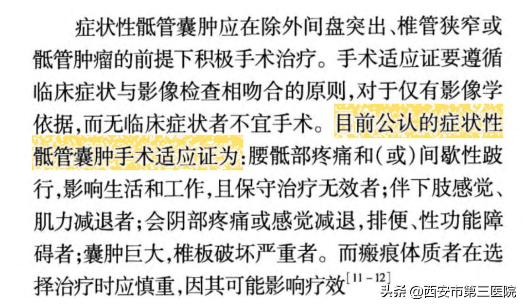 【医者解读】揭开“骶管囊肿”之神秘面纱，查出骶管囊肿都需要治疗吗？（手术病例+文献回顾）
