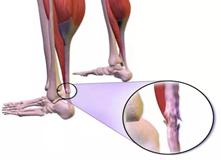 张蓓雯跟腱断裂含泪退赛,张蓓雯跟腱断裂复出恢复