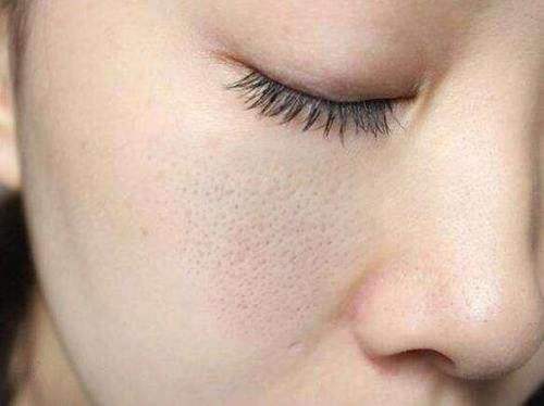 毛孔粗大怎么办教你一招,毛孔粗大怎么办护肤步骤