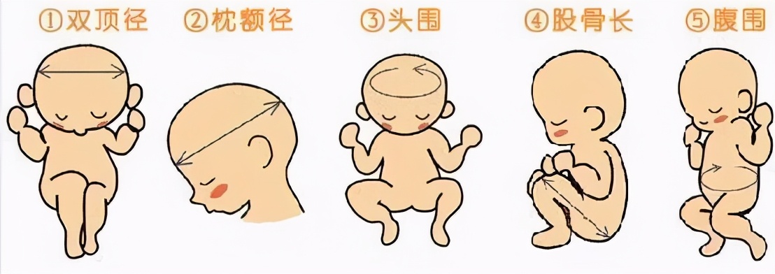 照了三维还要照四维吗,做了四维还要做三维吗