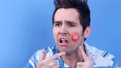 什么精油用了最容易长痘,玫瑰清痘精油