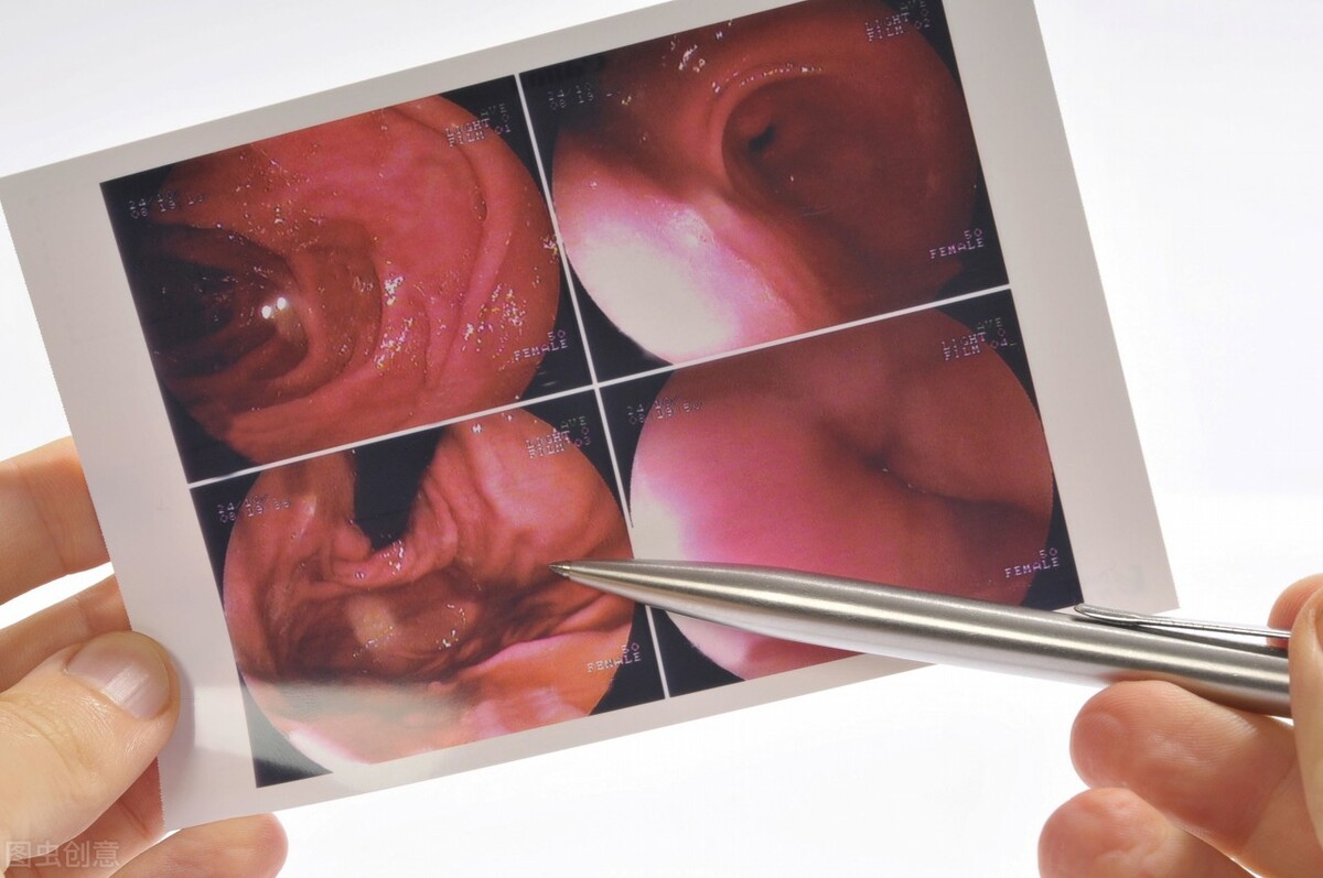 胃出血禁食禁水几天饿了怎么办,胃出血禁水禁食疯狂挂水