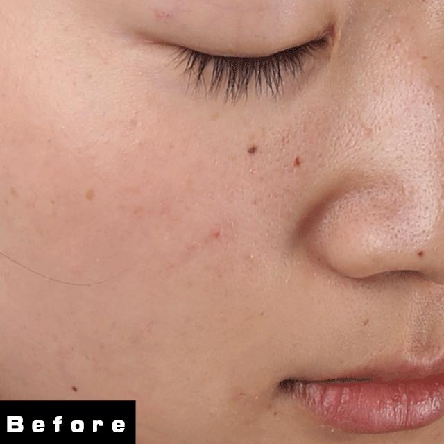 用了很多护肤品还是不白,白月光护肤品哪个更提亮皮肤