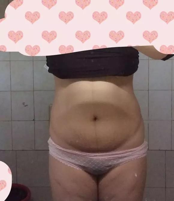 造成产后肥胖的案例,宝妈产后肥胖