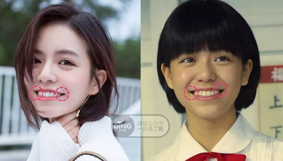 戴牙套凸嘴怎么化妆,凸嘴整牙削骨吗