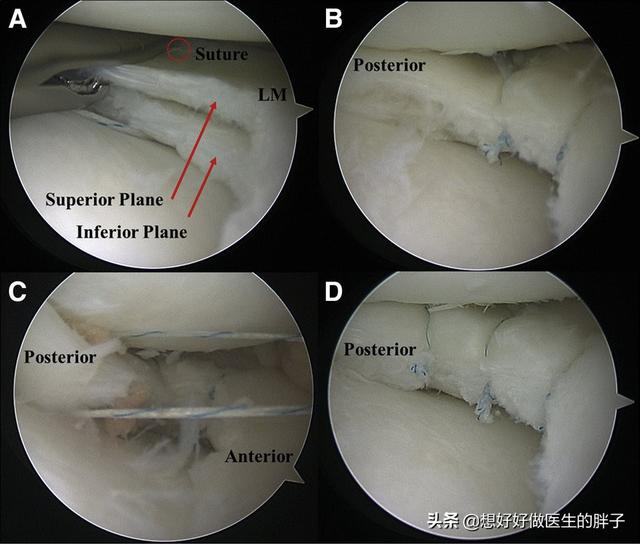 膝盖走路不怎么疼躺下就疼,儿童膝盖不动就不疼一走路就疼