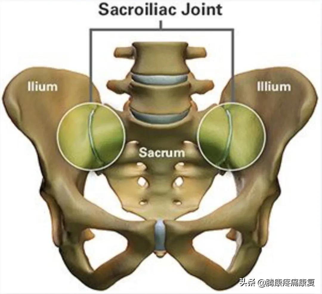 骶髂关节疼痛一招解决,缓解骶髂关节疼痛的六个训练动作