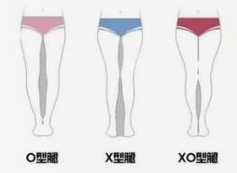 腿很粗裤子怎么穿好看,腿特别粗还短穿什么裤子好看