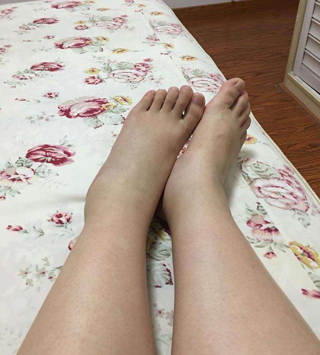 桥本甲减服药治疗效果仍然不佳，心率达到110次/分，真无法可治？