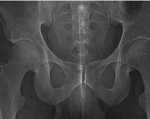 不作死就不会死看看你中了几条,不作死就不会死让人看的头皮发麻