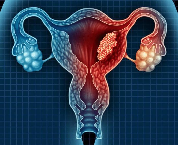 女人上了节育环会出现宫外孕吗,女人上了节育环