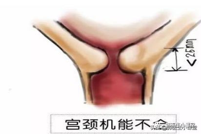 流产7次还能流产吗,怀孕10次流产10次