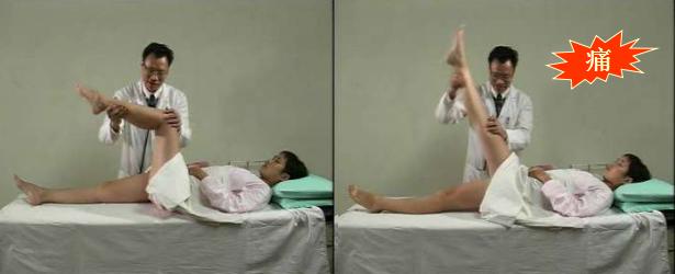 腰椎间盘突出针灸有副作用吗,腰椎间盘突出针灸越来越严重