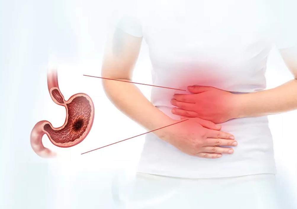 感染幽门螺杆菌只吃甲硝唑有用吗,感染幽门杆菌只能吃药吗