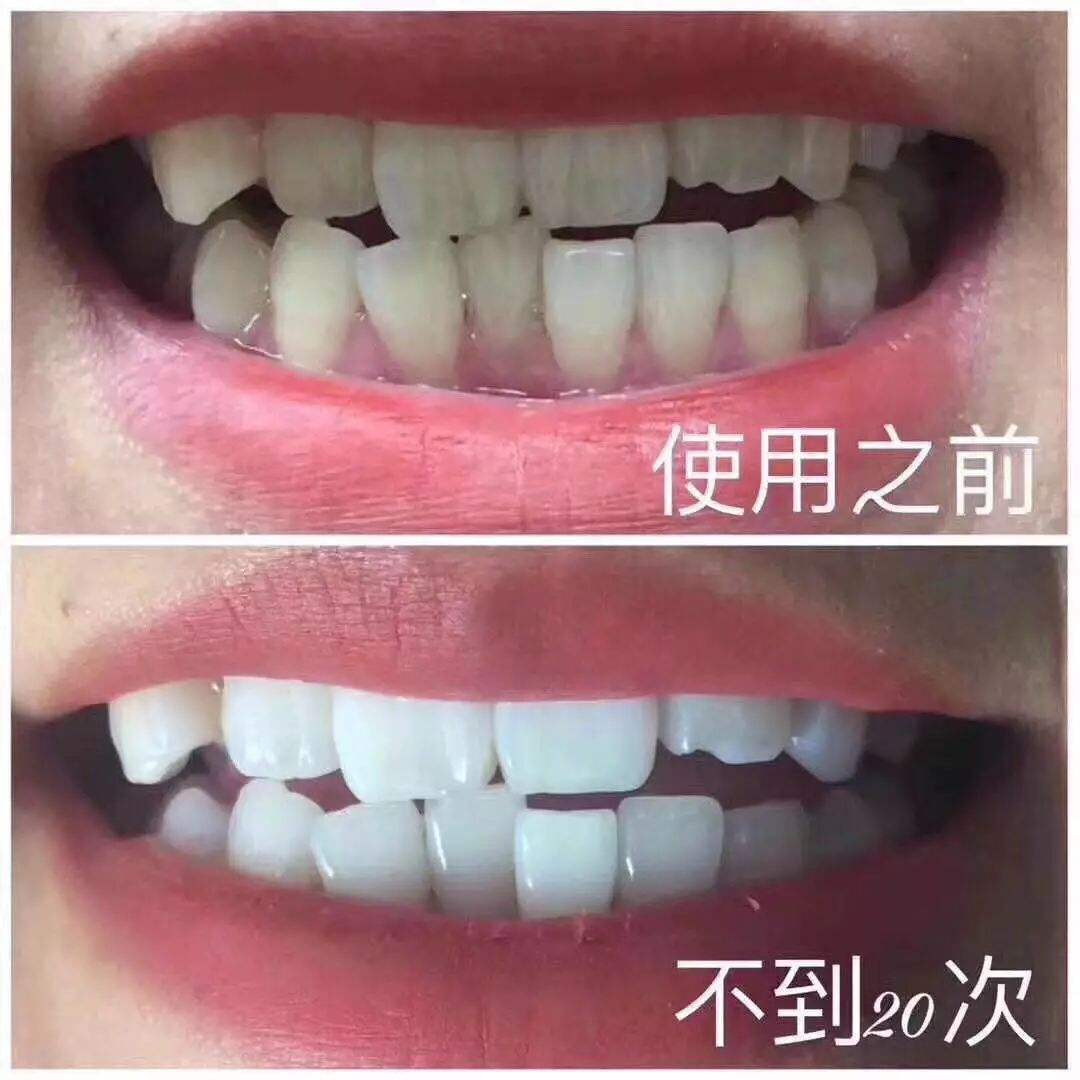 盘点全球9款真正好用的人气牙膏,牙膏界顶流炫白牙膏