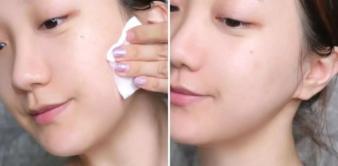 适合夏天油皮痘肌的水乳测评,fresh水乳适合敏感肌油皮