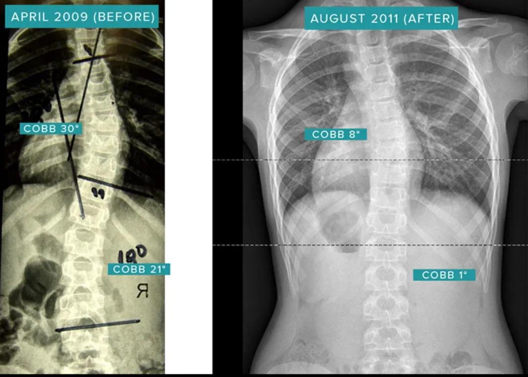 sps鍒涘浜虹悊鏌ュ痉,鐞嗘煡寰蜂翰鎺坰ps瀵煎笀