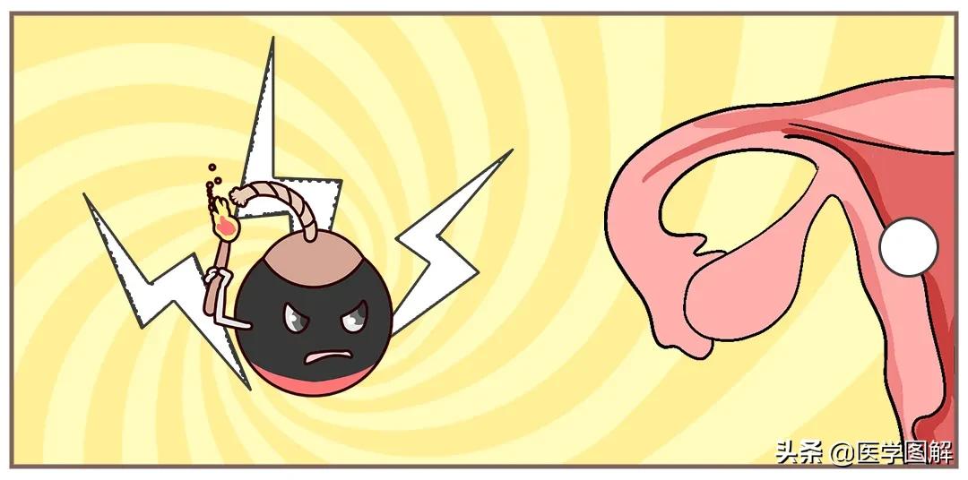 子宫肌瘤，比你想象的可怕！瞬间就危在旦夕？丨医学图解