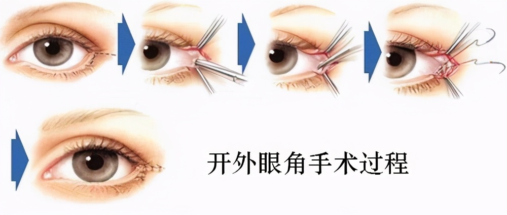 避雷指南靠谱吗,避雷注意事项及禁忌