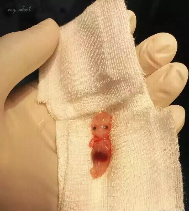 赵丽颖产子后现状,赵丽颖哪年产子