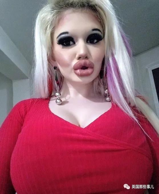 20次整容成功的女人,20次丰唇