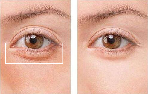 90后都30岁了还不懂事,90后的你快30岁了还一事无成