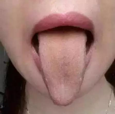 舌头一旦出现这个信号马上找中医,舌头一旦出现这个信号马上去医院