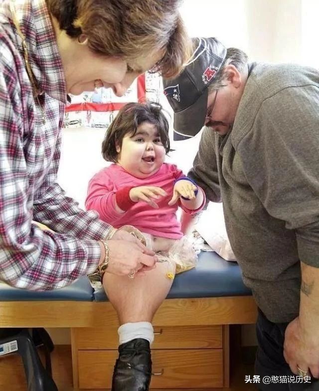 美人鱼真实存在的5件事,美人鱼婴儿畸形手术