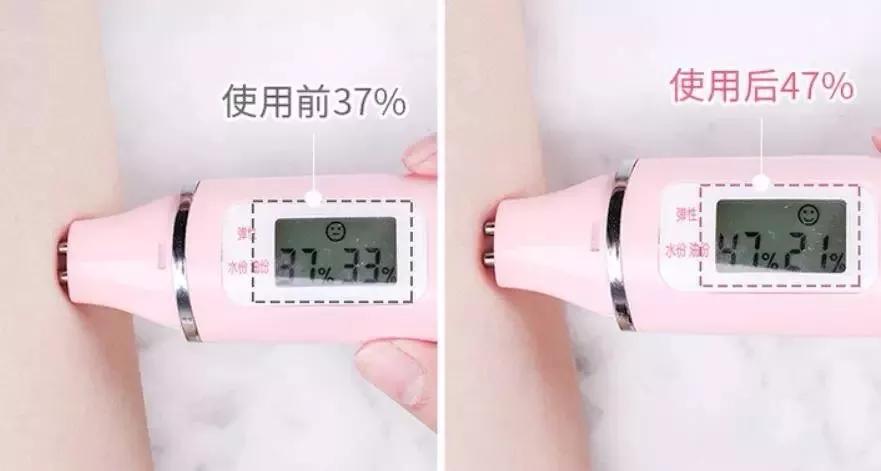 get何穗同款牛奶肌！秋冬去鸡皮，黑黄皮必入