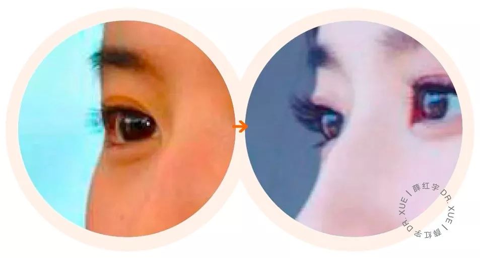 睫毛卷翘的方法半永久,睫毛卷翘定型